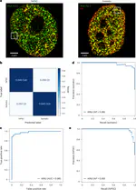 New AI Tool Scans STORM Images to Distinguish Cancer Cells from Normal Cells