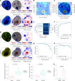 A deep learning method that identifies cellular heterogeneity using nanoscale nuclear features
