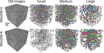 Current progress and challenges in large-scale 3D mitochondria instance segmentation
